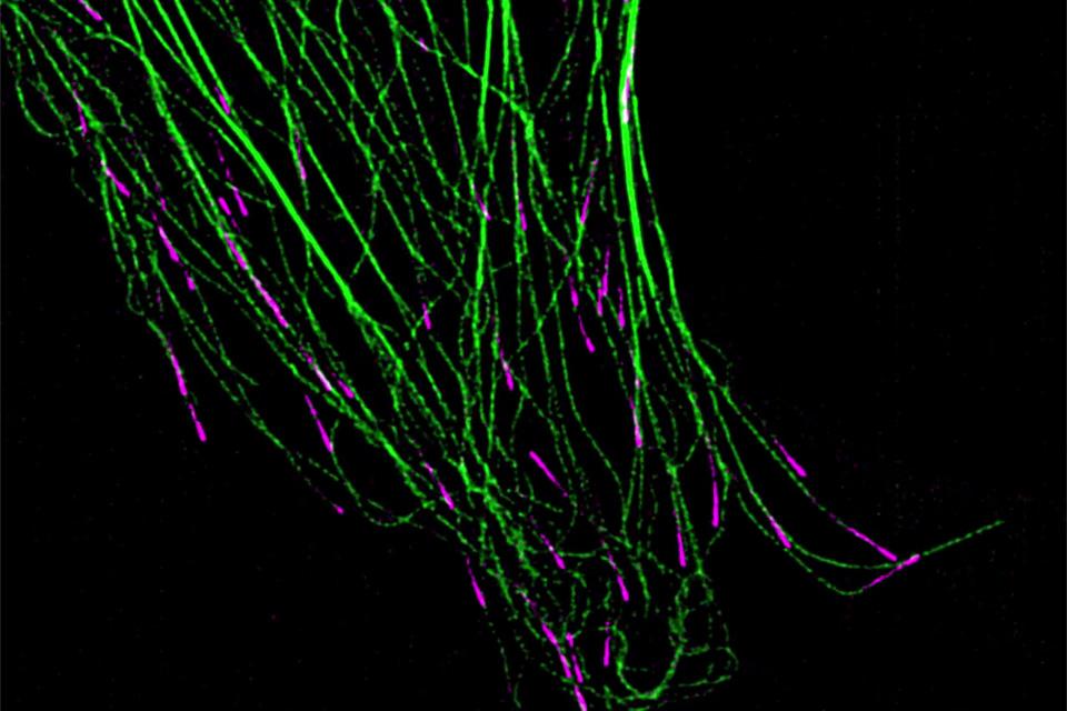 EMTB-3xGFP (grün) und EB3-tdTomato (magenta) exprimierende COS-7-Zelle, die dynamische Mikrotubulibewegungen sichtbar macht. Aufgenommen im Lattice SIM 9 Phase Mode. Objektiv: Plan-Apochromat 63×/1,4 Oil