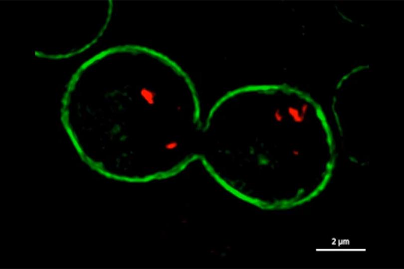 GFP-膜マーカーとmCherry-ゴルジ関連タンパク質を発現する生きた酵母の最大値投影像。試料ご提供：C. MacDonald, G. Calder & P. O’Toole (Department of Biology & Bioscience Technology Facility, University of York, UK)