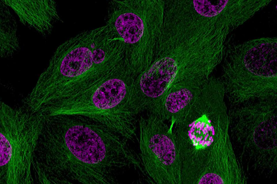 H2B-mCherry (magenta) und α-Tubulin mEmerald-GFP (grün) exprimierende LLC PK1-Zellen. Die Daten sind als Maximumintensitätsprojektion von 12 Ebenen über eine Tiefe von 3,7 µm dargestellt. Die hohe Empfindlichkeit von Elyra 7 ermöglicht die Abbildung des gesamten Sehfelds während der Mitose. Objektiv: LD LCI Plan-Apochromat 25×/0,8 Imm Korr