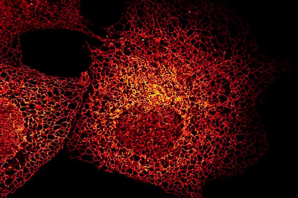 Cellules COS-7 exprimant le marqueur du réticulum endoplasmique Calreticulin-tdTomato. Données présentées sous forme de projection d'intensité maximale de 12 plans sur une profondeur de 1,4 µm. Objectif : Plan-Apochromat 40× / 1.4 huile