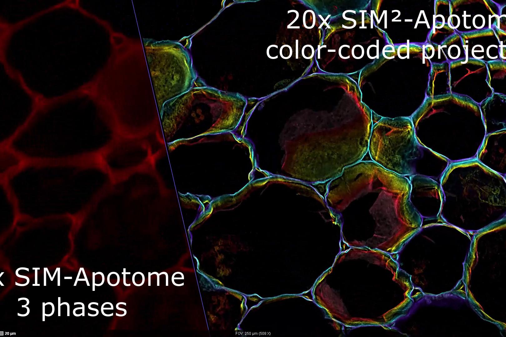 Imagen de volumen con función de mosaico de una sección fina de mora. Datos mostrados como máxima proyección de intensidad en 11 µm de profundidad. Tiempo de adquisición: Inferior a 2 min. Objetivo: EC Plan-Neofluar 10× / 0,3 aire. Muestra: «Maulbeere» (Mora) de TS-Optics Set Dauerpräparate Botanik 25St.