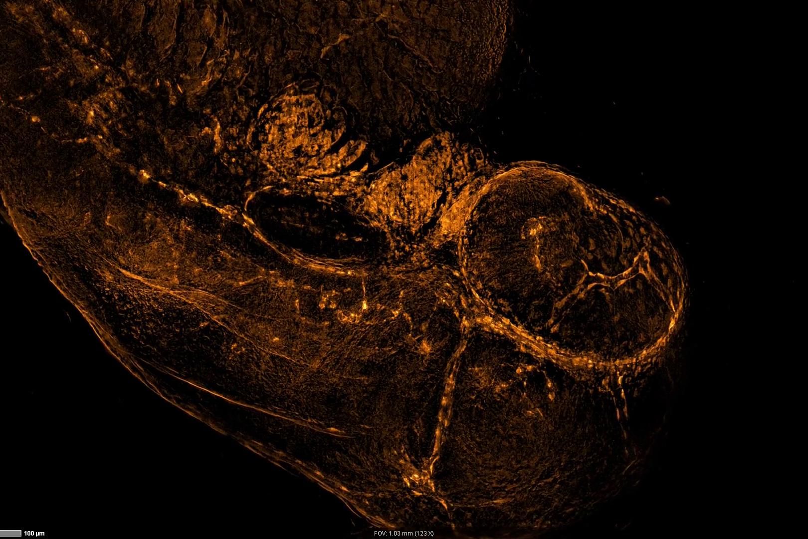 3D-Aufnahme eines den vaskulären Marker fli1-EGFP exprimierenden Zebrafischembryos. Die Abbildung zeigt die Maximumintensitätsprojektion des Z-Stapel-Datensatzes der Kachelaufnahme. Objektiv: Plan-Neofluar 10×/0,3. Probe mit freundlicher Genehmigung vom Haass Lab (MCN, Universität München, Deutschland)