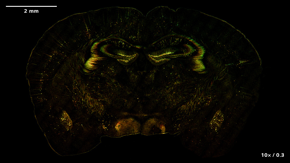 SIM² Apotome and Lattice SIM² images of a murine brain expressing the neuronal marker Thy1-eGFP. The images show the color-coded or maximum intensity projections of the volume data. Sample courtesy of Herms Lab (MCN, University of Munich, Germany)