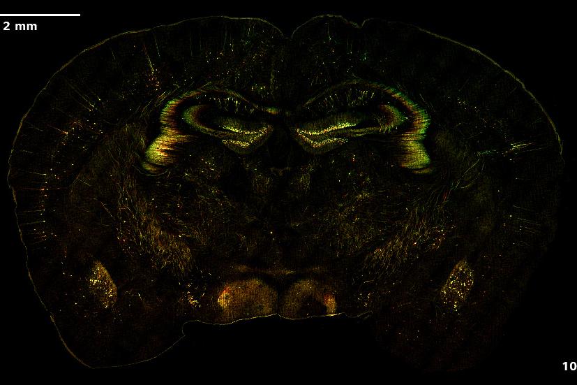 SIM² ApotomeとLattice SIM²による、ニューロンマーカーThy1-eGFPを発現するマウス脳の画像。ボリュームデータの色分け像または最大値投影像。