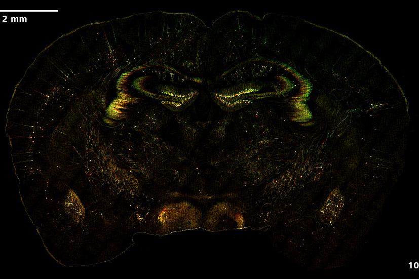 SIM² Apotome und Lattice SIM² Bilder eines Mäusegehirns mit neuronalem Marker Thy1-eGFP. Die Bilder zeigen die farbkodierten Maximumintensitätsprojektionen der Volumendaten.