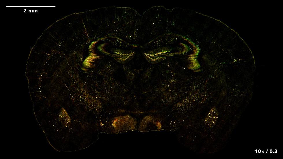 Imágenes de SIM² Apotome y Lattice SIM² de un cerebro de murino con expresión del marcador neuronal Thy1-eGFP. Las imágenes muestran las proyecciones de máxima intensidad o codificadas por colores de los datos de volumen.