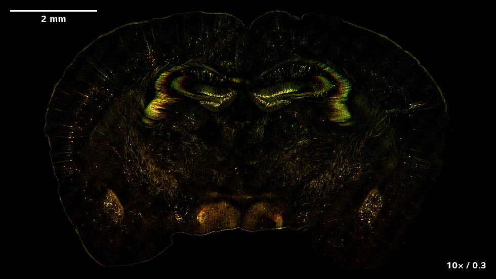 SIM² Apotome and Lattice SIM² images of a murine brain expressing the neuronal marker Thy1-eGFP. The images show the color-coded or maximum intensity projections of the volume data.