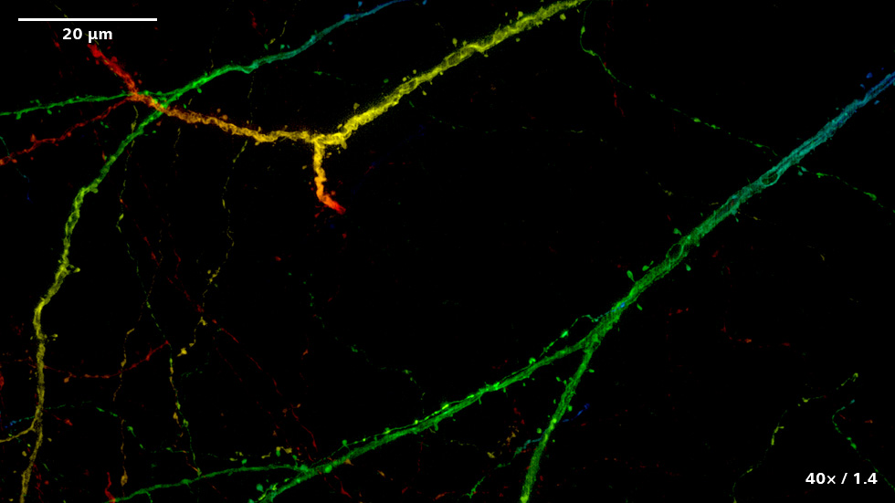 SIM² ApotomeとLattice SIM²による、ニューロンマーカーThy1-eGFPを発現するマウス脳の画像。ボリュームデータの色分け像または最大値投影像。 試料ご提供：Herms Lab (MCN, University of Munich, Germany)