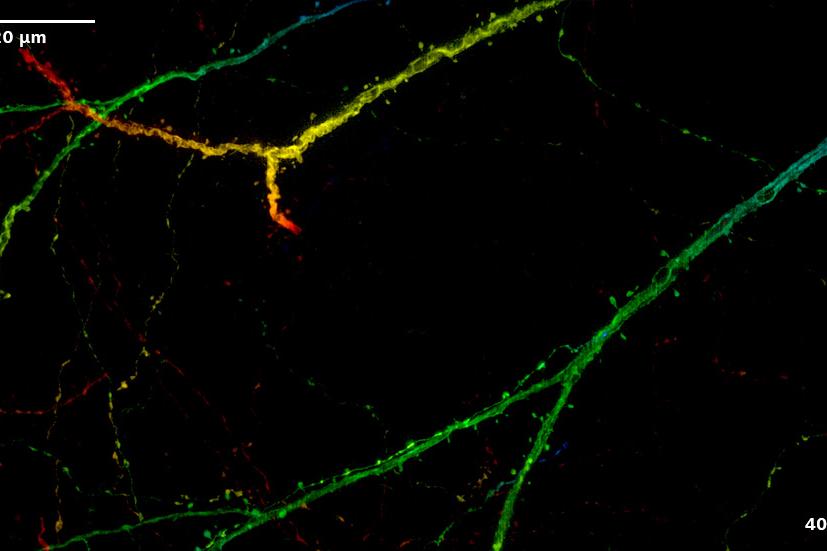 Imágenes de SIM² Apotome y Lattice SIM² de un cerebro de murino con expresión del marcador neuronal Thy1-eGFP. Las imágenes muestran las proyecciones de máxima intensidad o codificadas por colores de los datos de volumen.