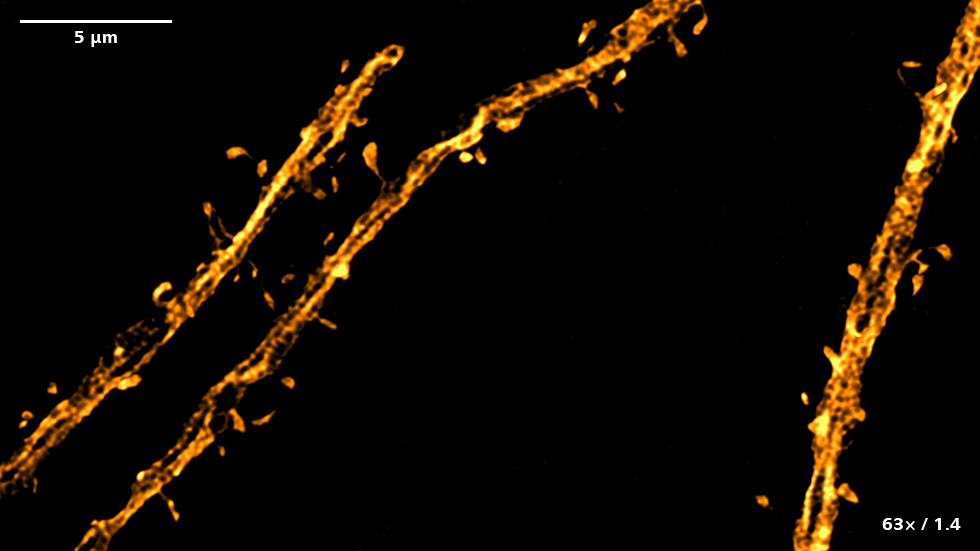 Images SIM² Apotome et Lattice SIM² d'un cerveau murin exprimant le marqueur neuronal Thy1-eGFP. Les images représentent le codage couleur ou les projections d'intensité maximale des données de volume. Échantillon fourni avec l'aimable autorisation de Herms Lab (MCN, Université de Munich, Allemagne)