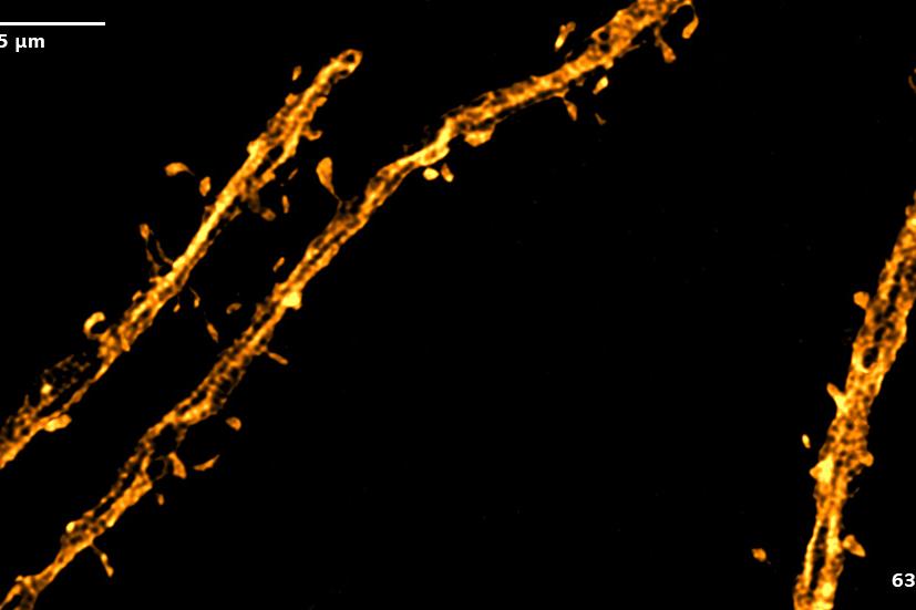 SIM² Apotome and Lattice SIM² images of a murine brain expressing the neuronal marker Thy1-eGFP. The images show the color-coded or maximum intensity projections of the volume data.