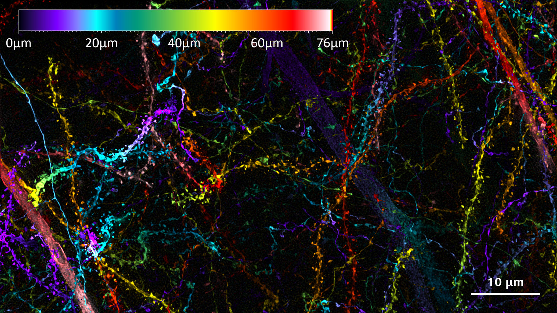 ニューロンマーカーThy1-eGFPを発現するマウスの脳を、Lattice SIM²モードで75 µmの深度でイメージング。 