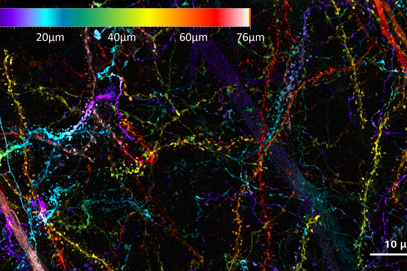 Cerebro de murino con expresión del marcador neuronal Thy1-eGFP, captado en el modo Lattice SIM en un rango de Z-stack de 75 µm. 