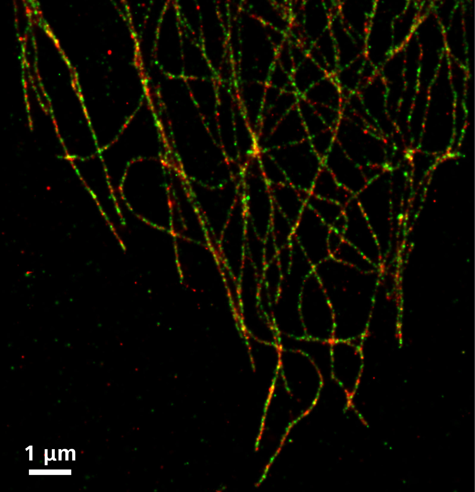 SMLM：αチューブリンはAlexa 555で、βチューブリンはAlexa 488で標識。 