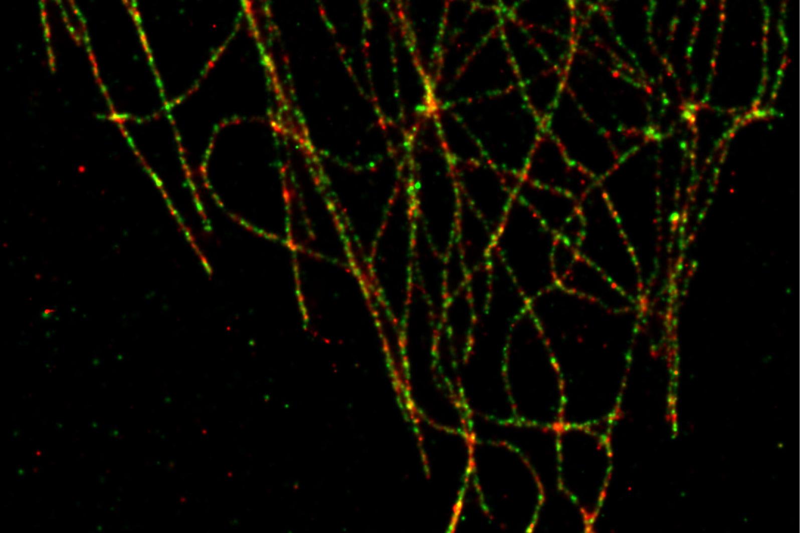 SMLM: Alpha-Tubulin wurde mit Alexa 555 und Beta-Tubulin mit Alexa 488 markiert.