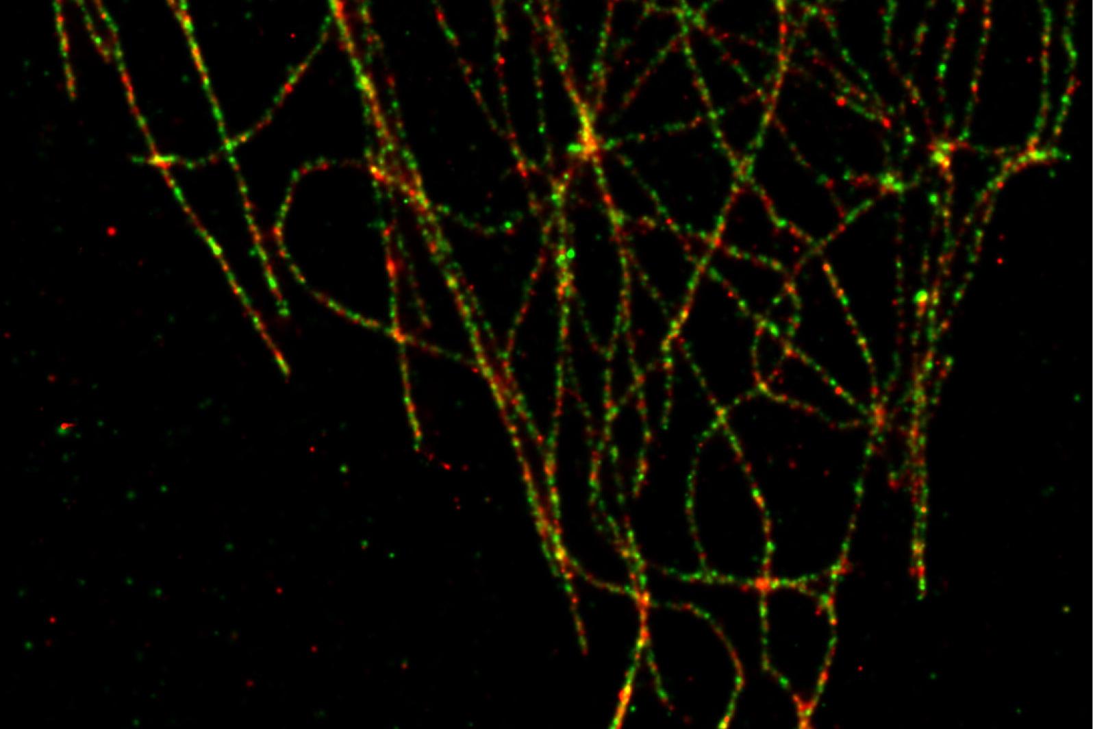 SMLM: Alpha tubulin was labelled with Alexa 555 and beta tubulin with Alexa 488.