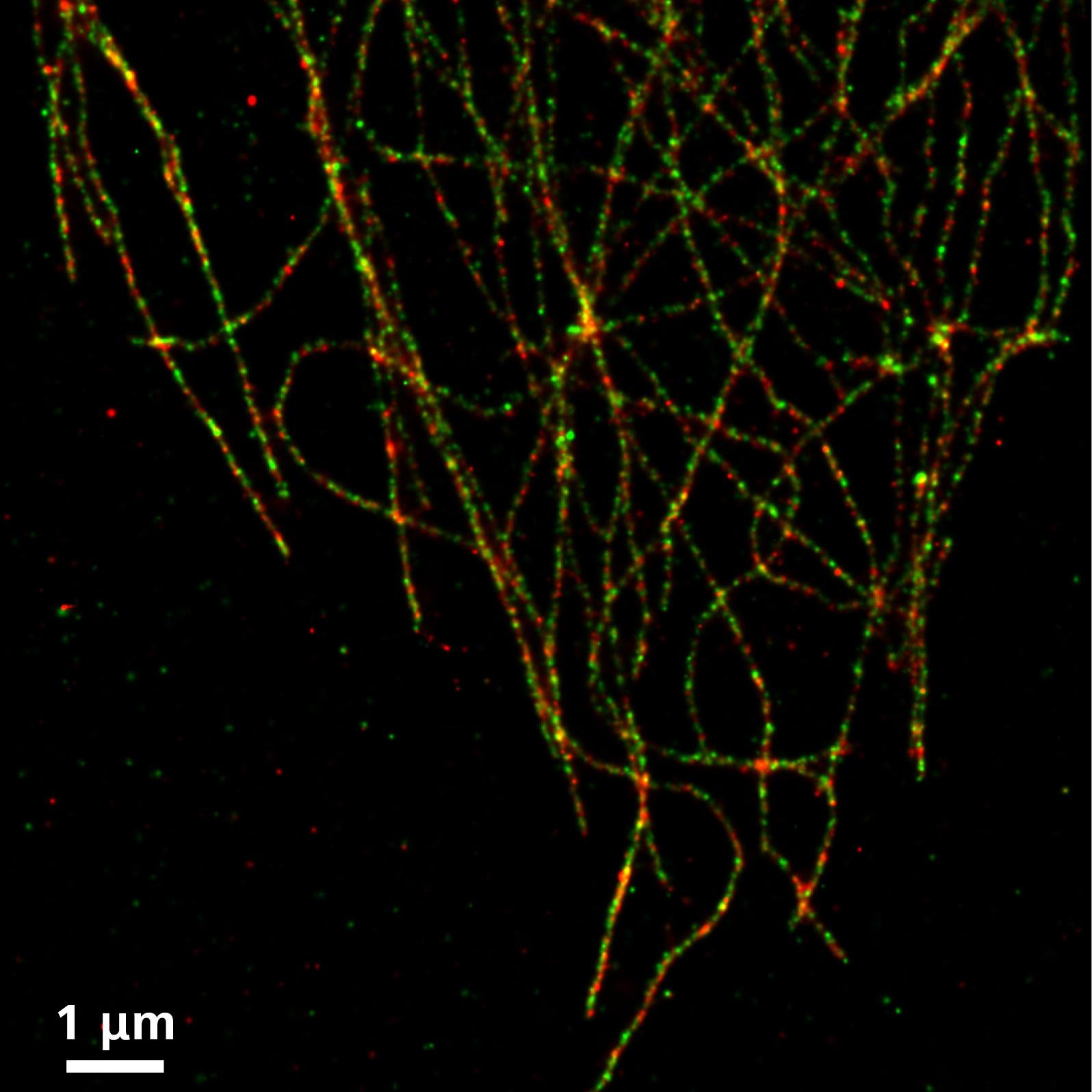 SMLM: Se marcó la alfa-tubulina con Alexa 555 y la beta-tubulina con Alexa 488.