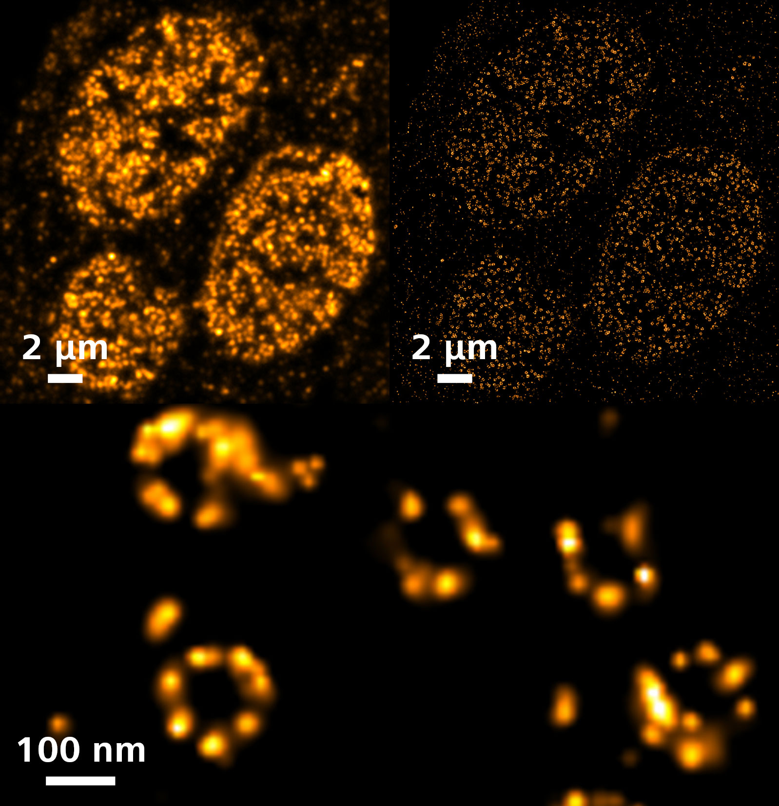 SMLM：A6细胞中核孔复合体的八重对称性结构。 