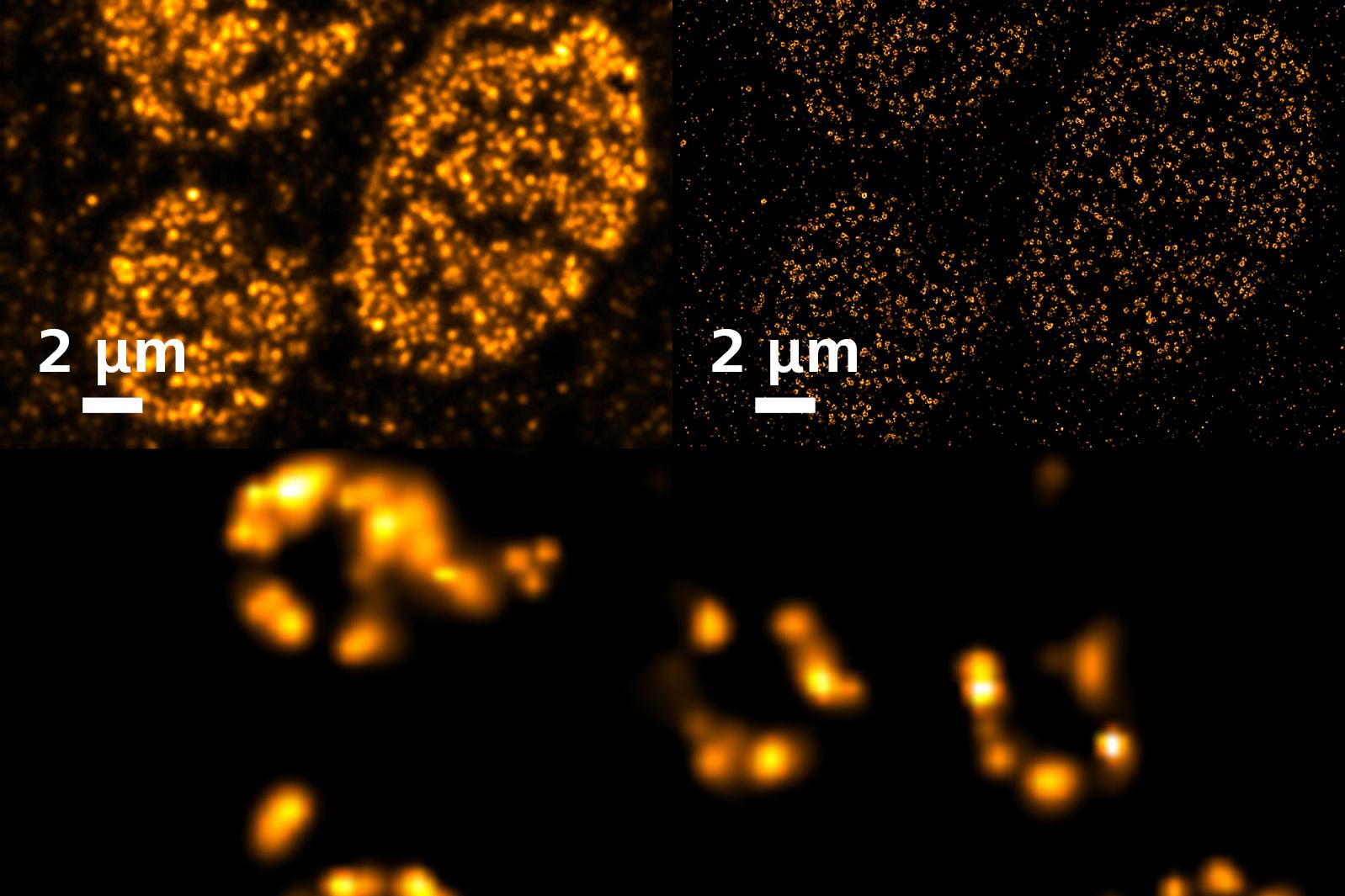 SMLM: Simetría de orden ocho del complejo del poro nuclear en una célula A6.