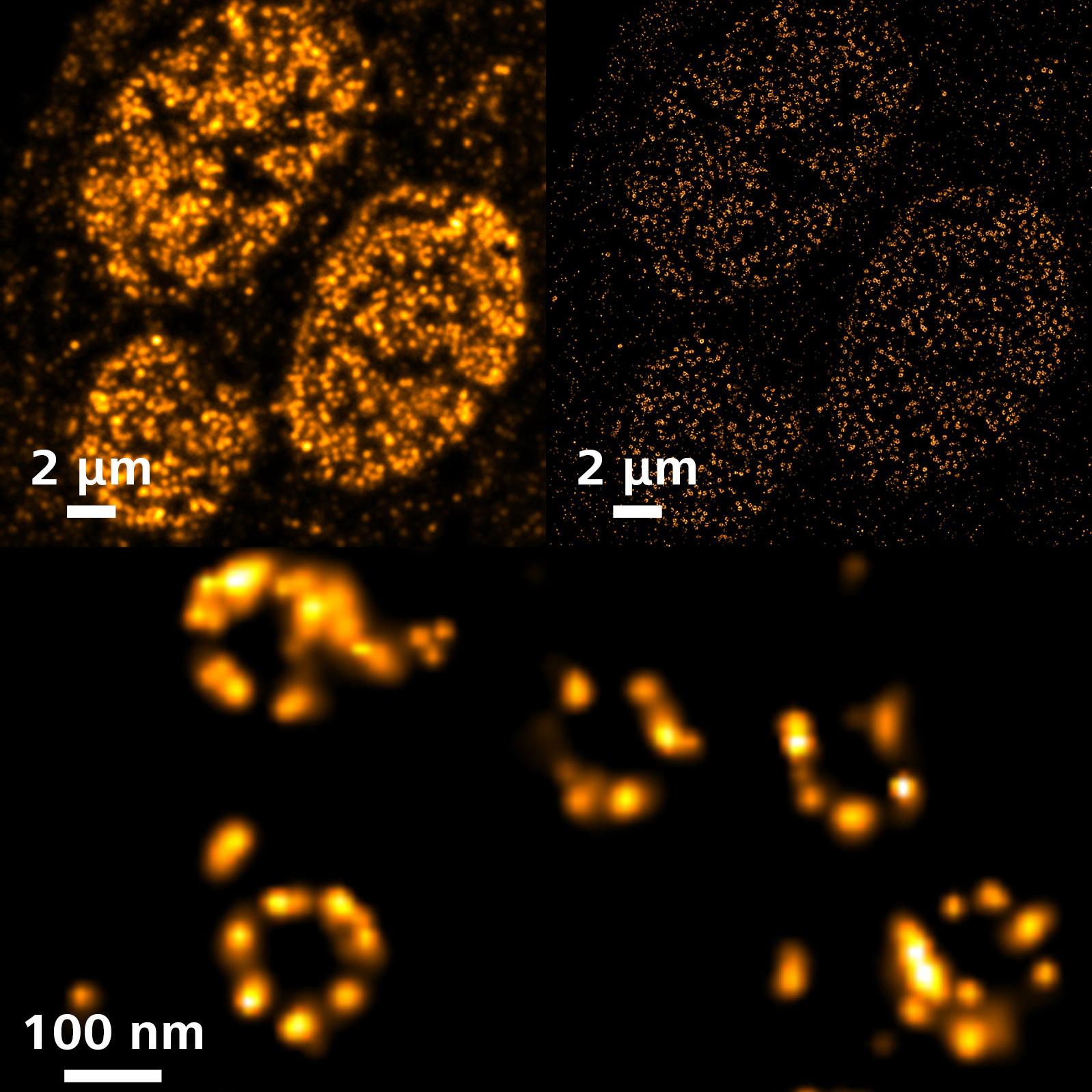 SMLM: Eightfold symmetry of the nuclear pore complex in A6 cell.