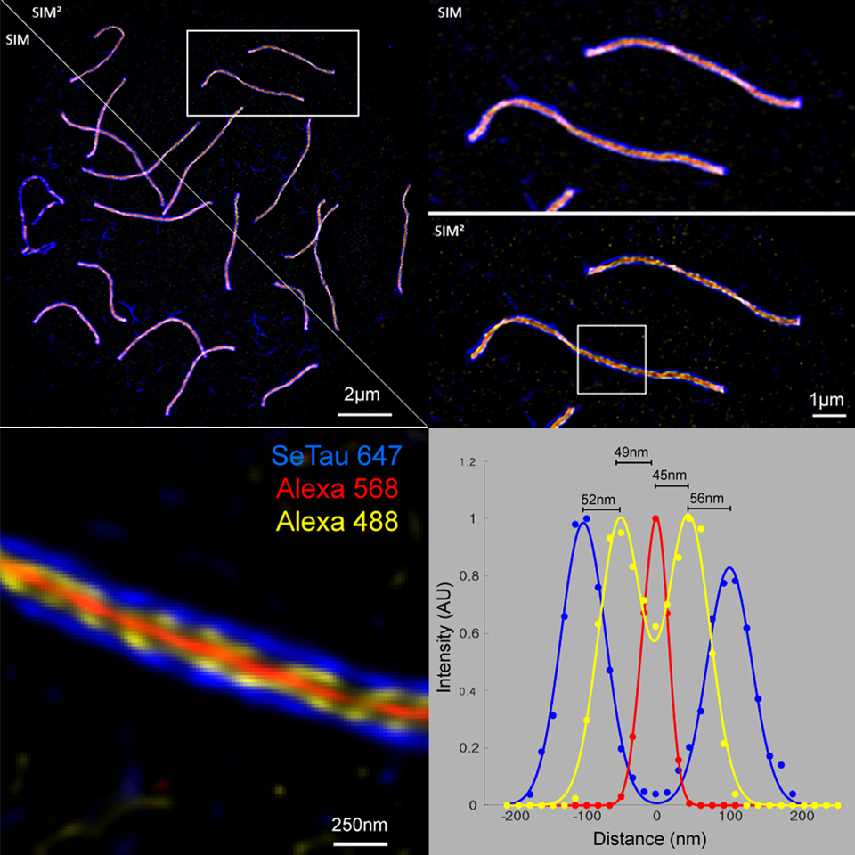 Aufbau dreifach markierter synaptonemaler Komplexe in Mäusehoden, die per Immunmarkierung von SYCP3 mit SeTau647, SYCP1-C mit Alexa 488 und SYCP1-N mit Alexa 568 im Lattice SIM² Modus visualisiert wurden. Marie-Christin Spindler, AG Prof. Ricardo Benavente, Biozentrum der Universität Würzburg, Deutschland.