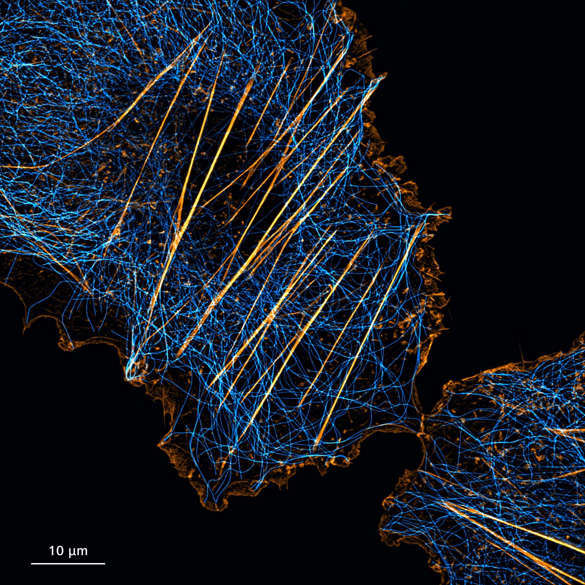 Cos-7 cells stained for microtubules (anti-tubulin Alexa Fluor 488, cyan) and actin (Phalloidin Alexa Fluor 561, orange)​