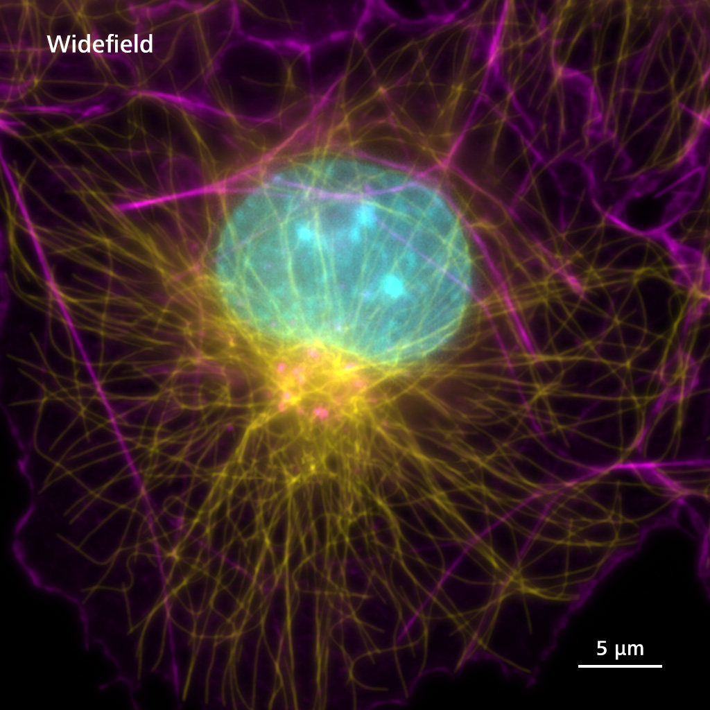 Widefield Lattice SIM