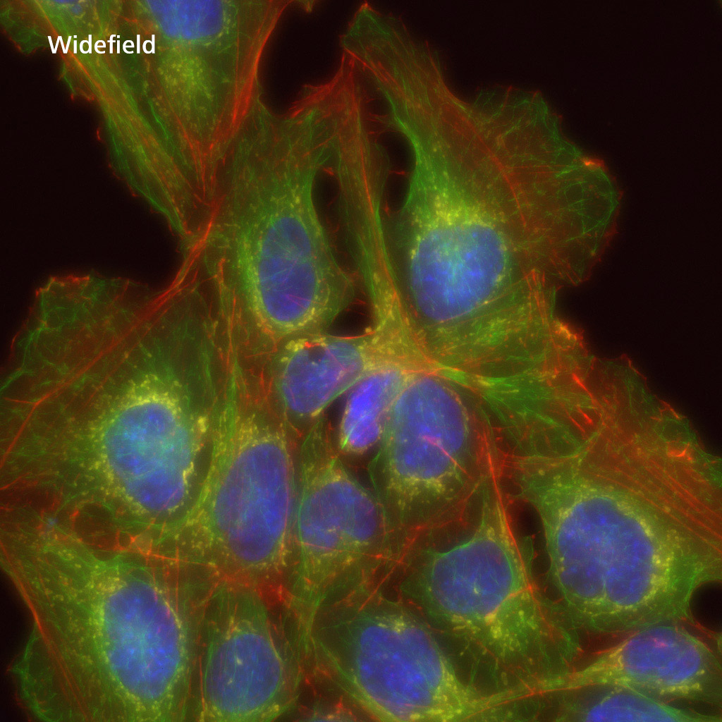 Widefield SIM Apotome