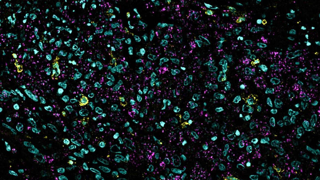 皮膚組織切片のデジタルズーム。寄生生物の可視化および定量化が可能