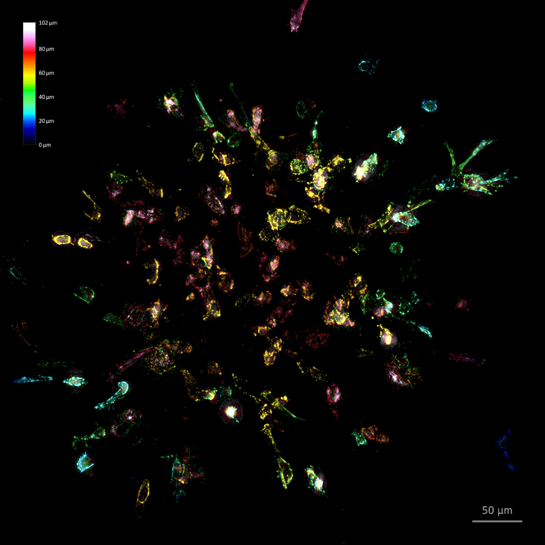 细胞球侵入胶原基质，细胞表达Lifeact-tdTomato，彩色深度投影。