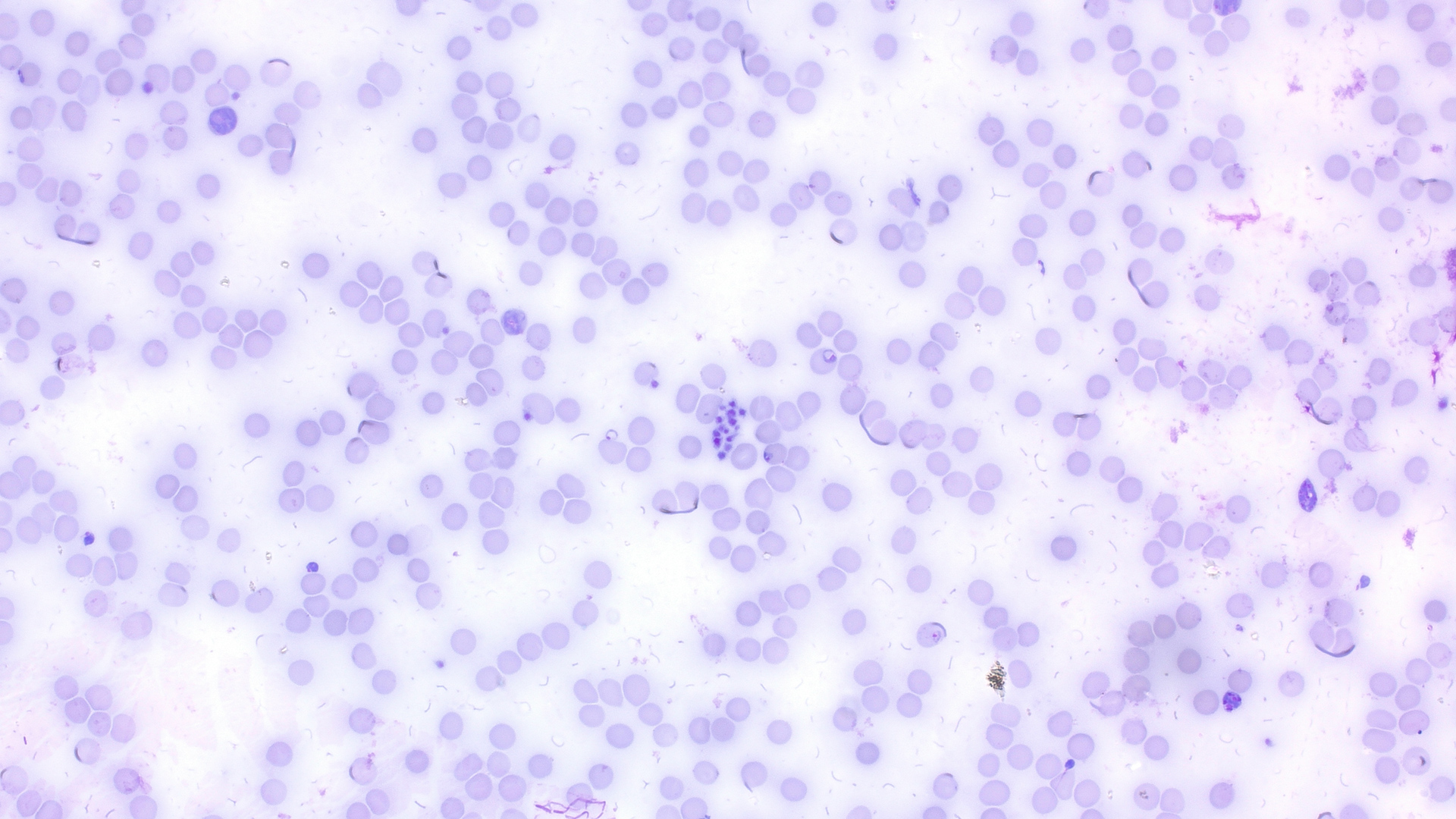 Anwendungsbeispiel: Plasmodium malariae in Hellfeldbeleuchtung  