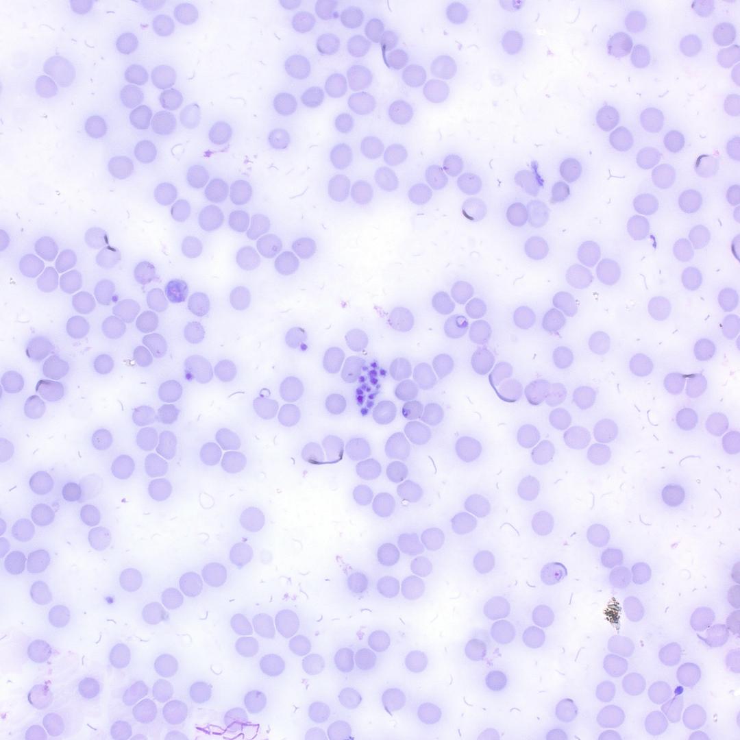 Anwendungsbeispiel: Plasmodium malariae in Hellfeldbeleuchtung 