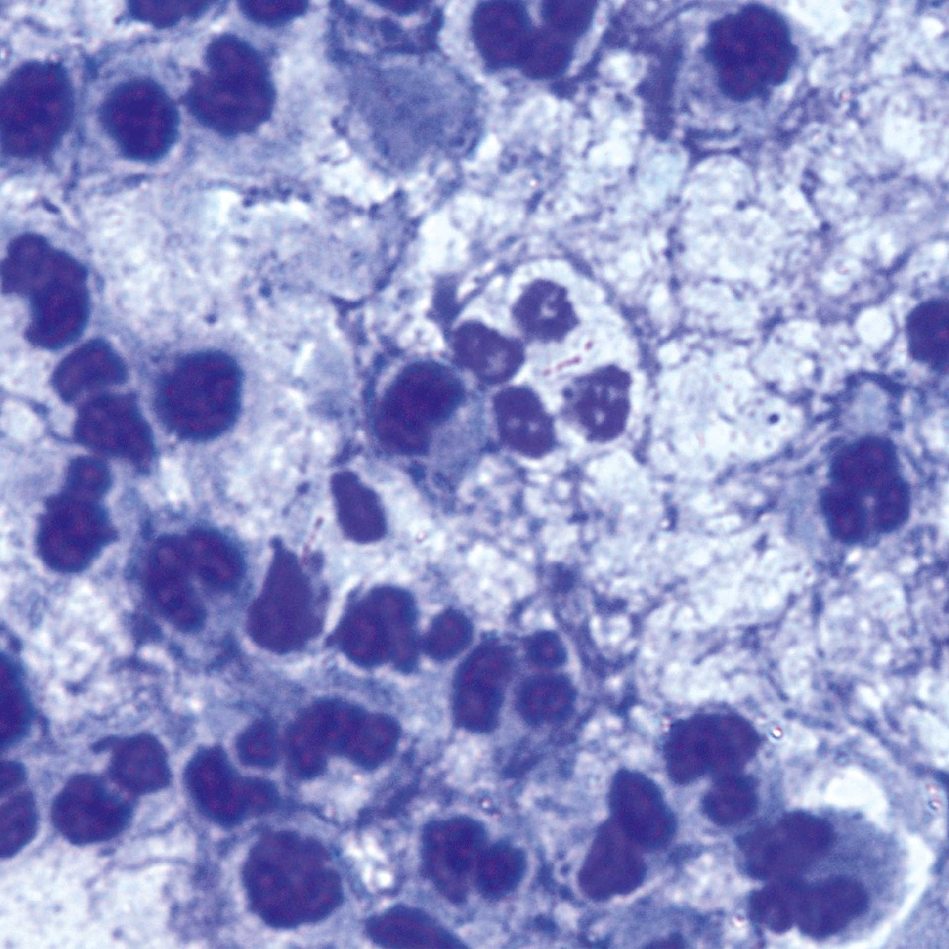 Representative example of tubercle bacilli in brightfield illumination