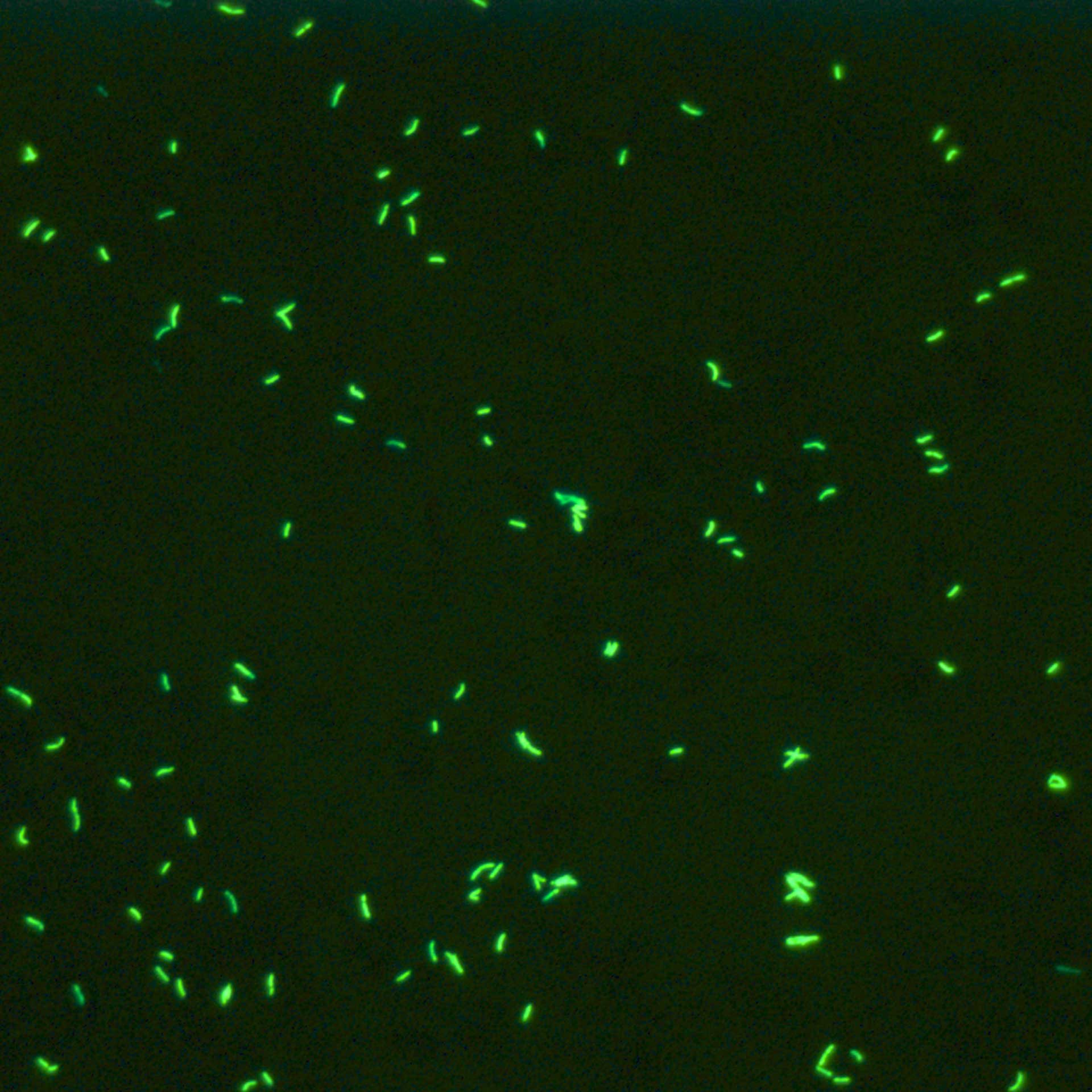 Exemple représentatif du bacille de Koch en éclairage à fluorescence 