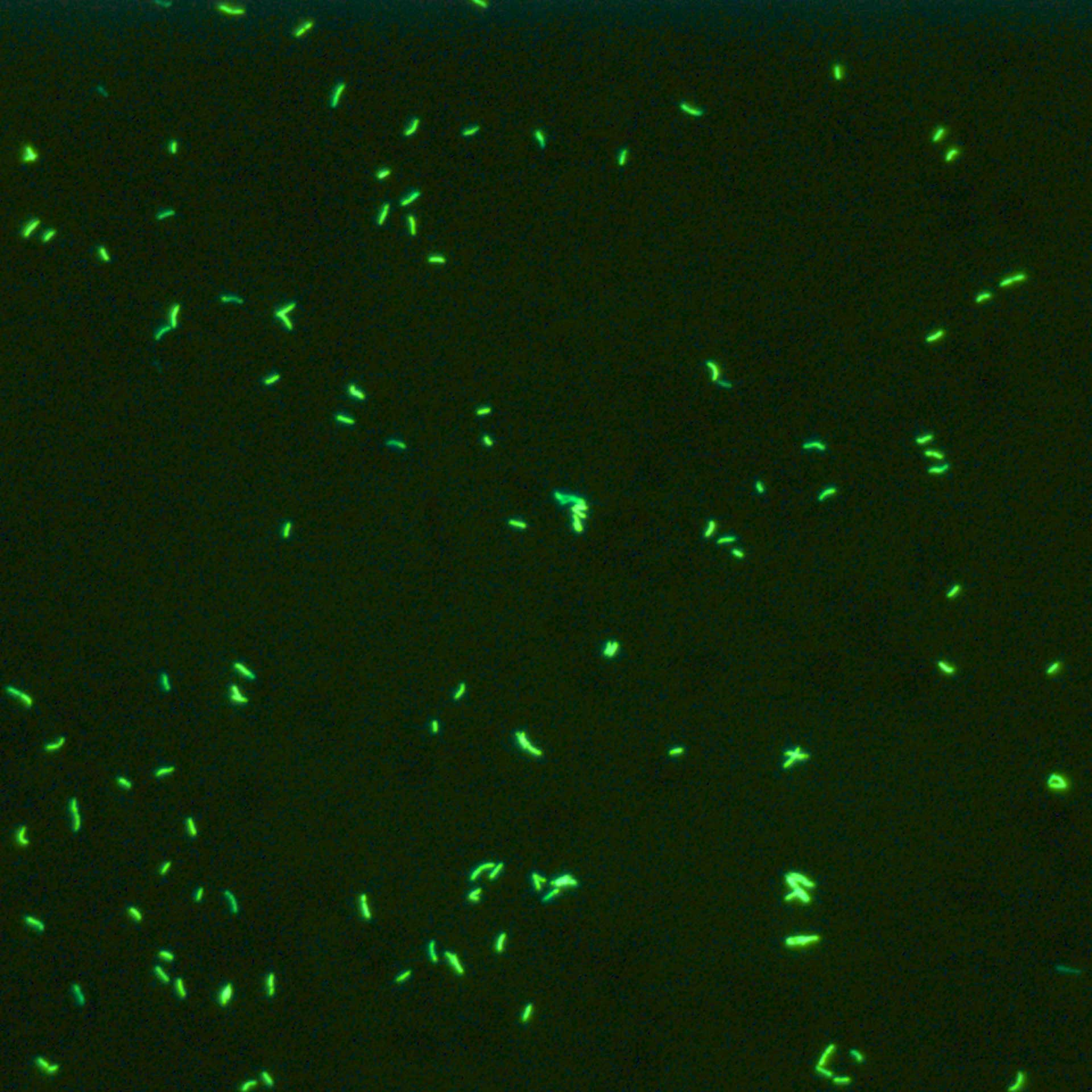 Imagerie en fluorescence, capturée avec le Primo Star iLED, coloration à l'auramine de la Mycobacterium tuberculosis, contre-coloration au bleu de méthylène