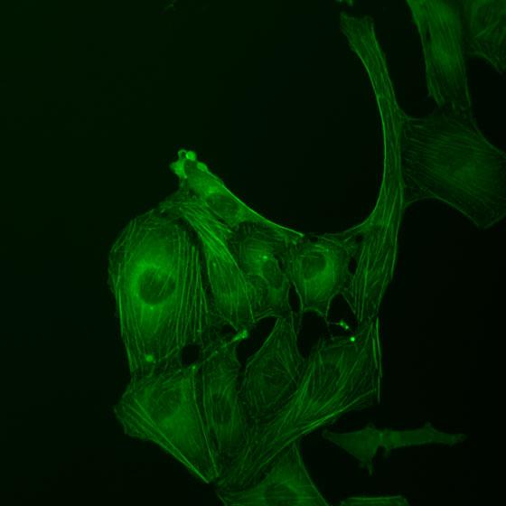 Células U20S, tinción de GFP, contraste de fluorescencia