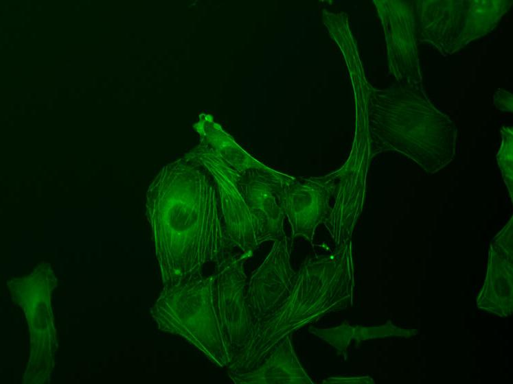 Células U20S, tinción de GFP, contraste de fluorescencia