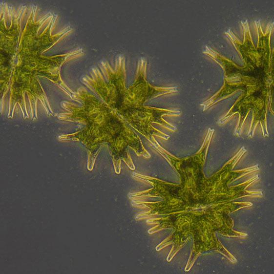 辐射微星鼓藻（藻类），明场观察方式