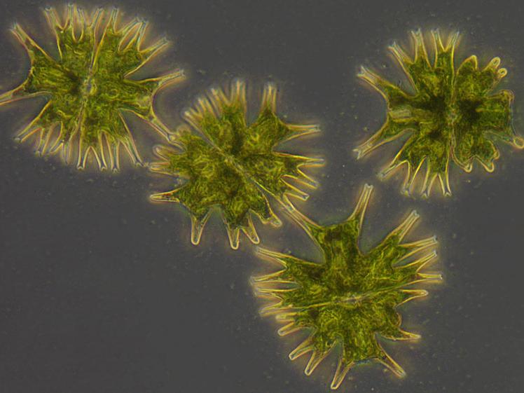 Micrasterias radiata (alga), contraste de campo claro