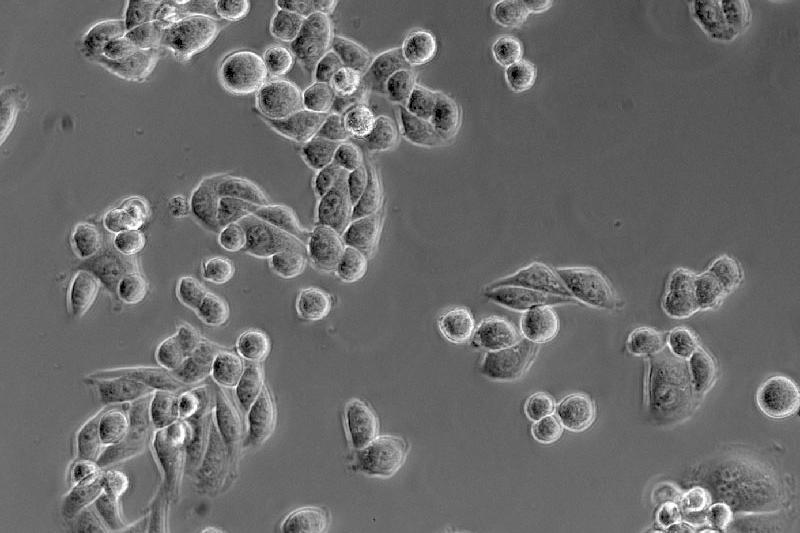 HeLa cells, phase contrast