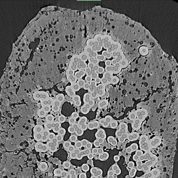 This FDK image, with labels, demonstrates significant noise in comparison to the DeepRecon Pro image