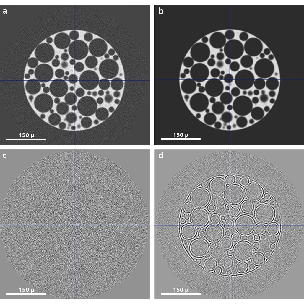 (a) Standard reconstruction; (b) DeepRecon Pro ImageClarity reconstruction; (c) test: noise removed with correct model; (d) features removed: incorrect model was selected.