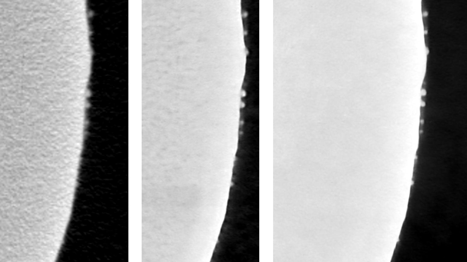 (Left) DeepScout with no ROI training; (Center) DeepScout with ROI training: halo removed; (Right) Inner streaking artifacts also removed