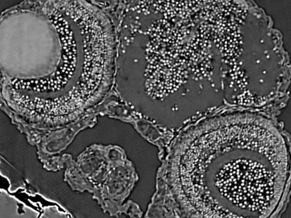 Image d'un échantillon de poisson zèbre capturée avec ZEISS 620 versa : reconstruite avec DeepRecon Pro