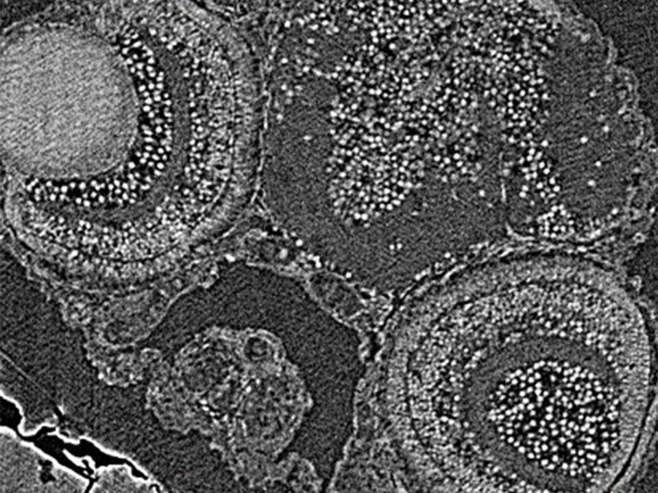 Probe eines Zebrafischs, abgebildet mit ZEISS 620 Versa: Standardrekonstruktion mit FDK