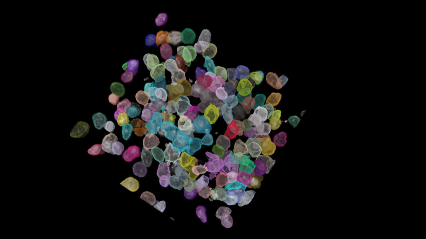 Neurospheres detected with pre-trained cellpose ai model.