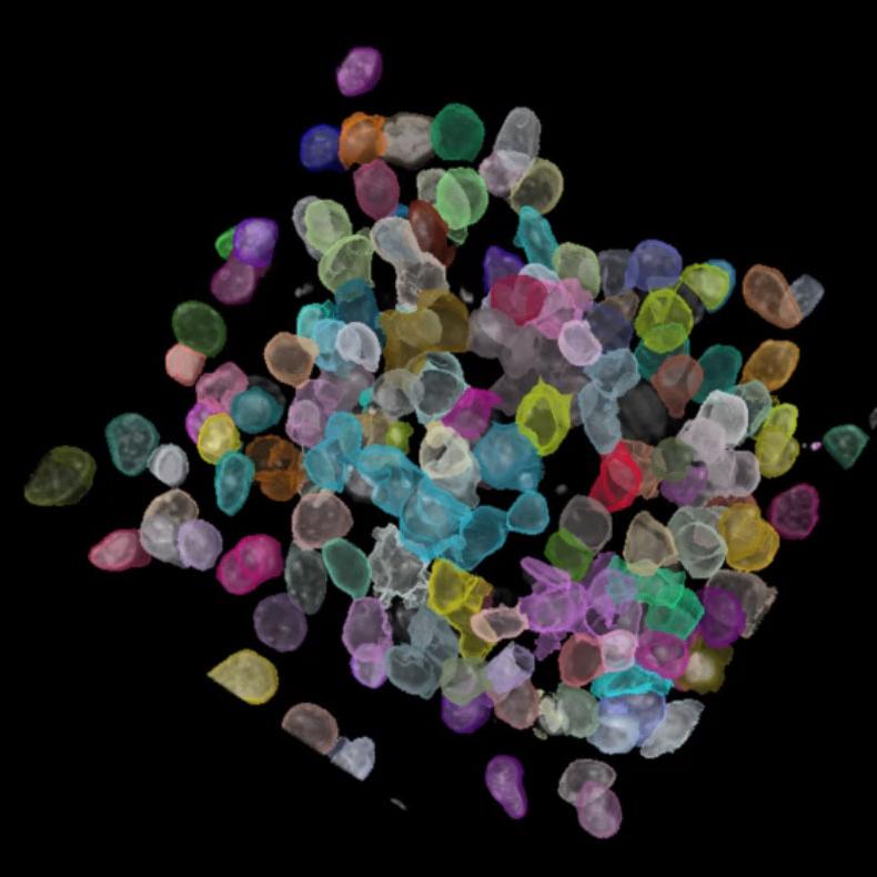 Neurospheres detected with pre-trained cellpose ai model.