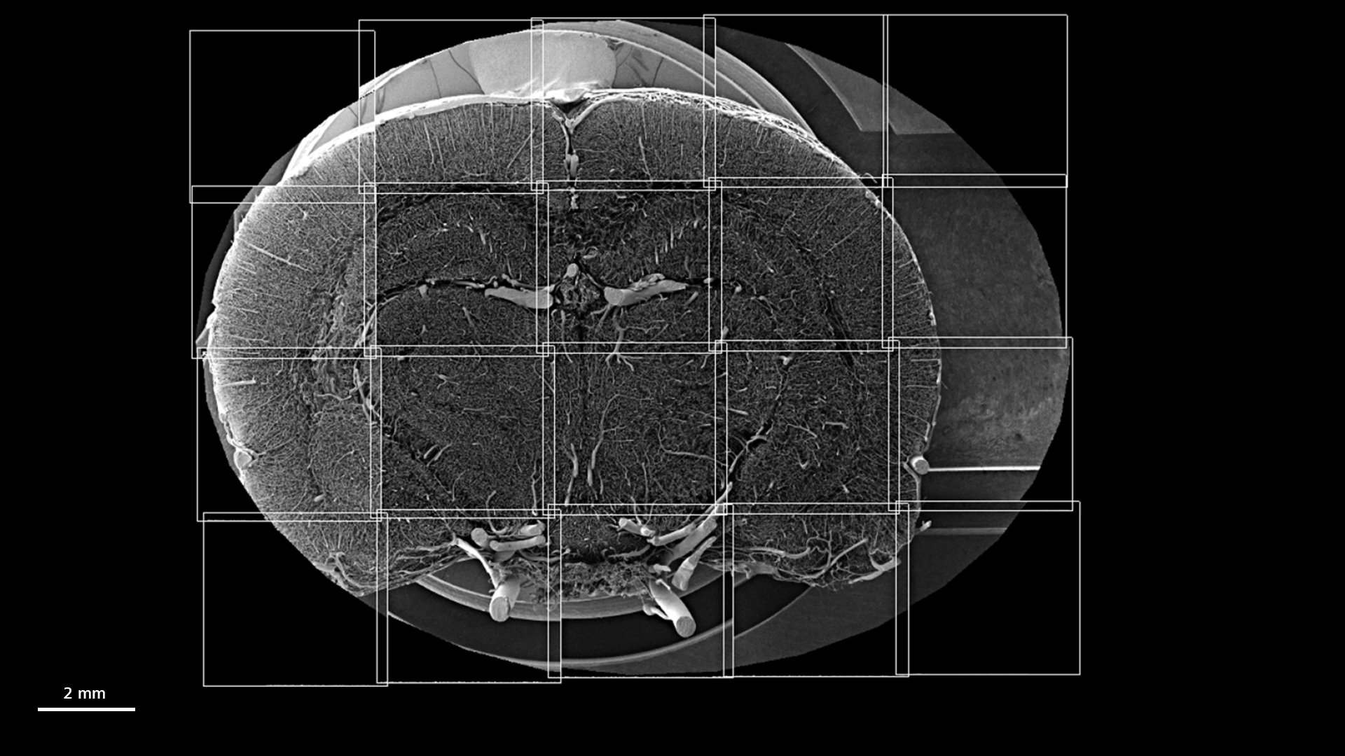 Blutgefäße eines Rattenhirns, dicker Schnitt, SEM-Bilder, Kachelaufnahme