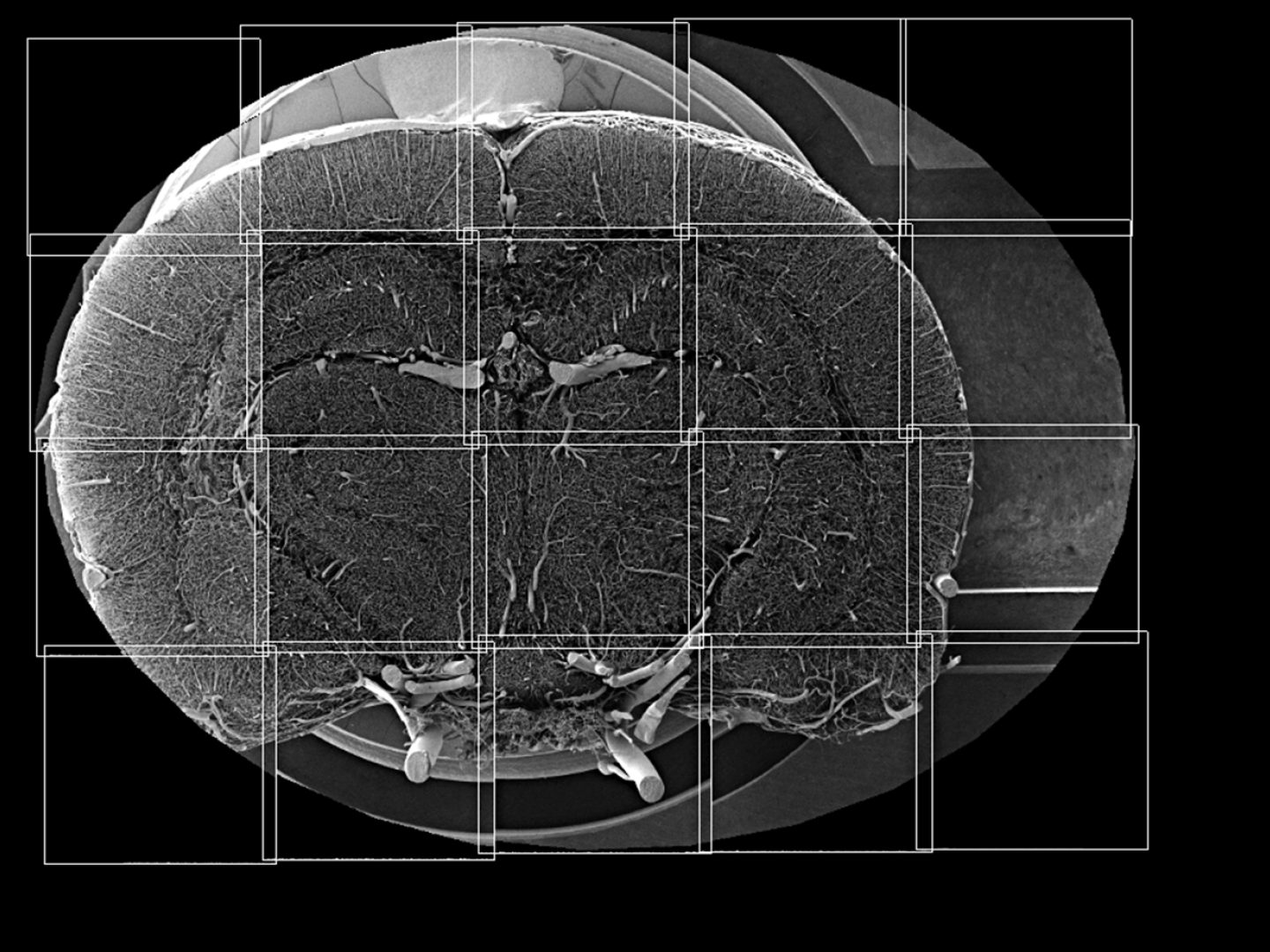 Vaisseaux sanguins du cerveau d'un rat, coupe épaisse, images au MEB, mosaïque