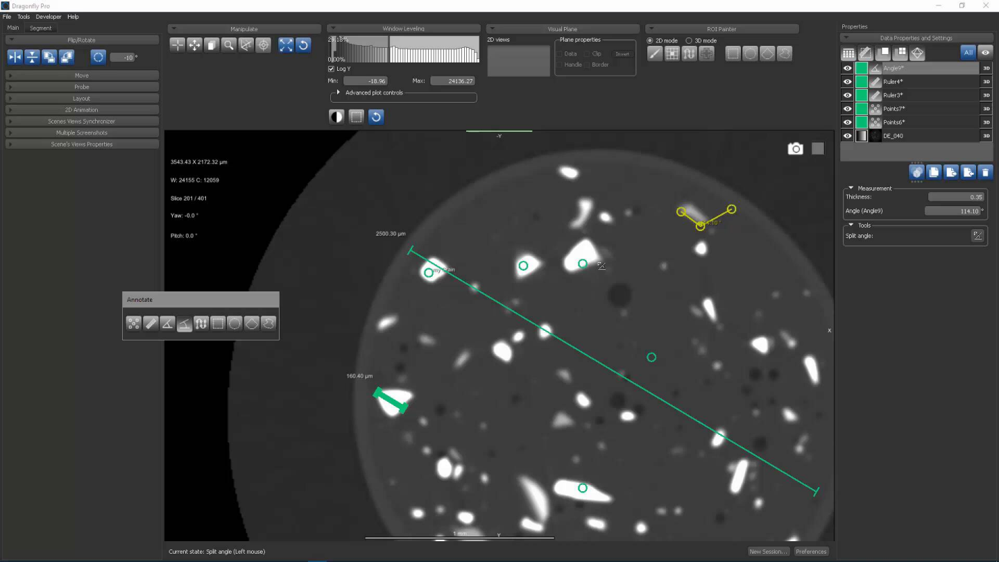 Dragonfly 3D World ZEISS edition